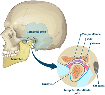 Temporal Bone TMJ Physical Therapy Wellspring PT